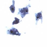 Naegleria fowleri.