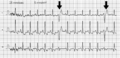 Pisipilt versioonist seisuga 18. jaanuar 2007, kell 05:38