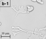 Balamuthia mandrillaris (trophozoite form)