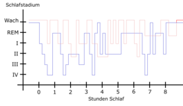 Slaappatroon van een patiënt met rusteloze benen (rood) versus een normaal slaappatroon (blauw).