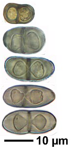 The ascospores of Physcia caesia are typical for the genus.