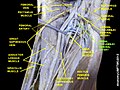 Medial circumflex femoral artery