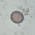 Egg of T. solium