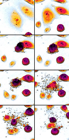 Een met etoposide behandelde kankercel valt uiteen via apoptose. Time-lapse-opnames gedurende 61 uur.