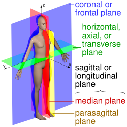 En 3D-modell av en människa med de anatomiska planen markerade. Frontalplanet är blått och delar kroppen i en främre och bakre del. Transversalplanet är grönt och delar kroppen i en övre och nedre del. Sagittalplanet är gult och delar kroppen i en höger och vänster del. Medianplanet, som är ett sagittalplan exakt längs kroppens mittlinje, är markerat i rött, medan ett parasagittalplan, som är en förskjutning från mittlinjen, är markerat i orange.