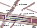 Zgradba bakterije Bacillus anthracis