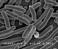 Elektronfotografi av Escherichia coli-bakteriar.