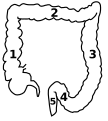 1: Ascending colon 2: Transverse colon 3: Descending colon 4: Sigmoid colon 5: Rectum