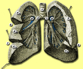 Anatomy of lungs