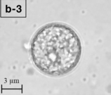 Balamuthia mandrillaris (cyst form)