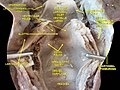 Dissection profonde du larynx, du pharynx et de la langue en vue postérieure