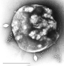 크레고균(Eocytes) 아마도 가장 풍부한 해양 고균일 것이다.