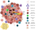 Thumbnail for Tumor microenvironment