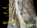 Spinal cord. Spinal membranes and nerve roots. Deep dissection. Posterior view