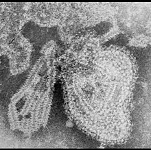 Mikrograf TEM zarah Mumps rubulavirus