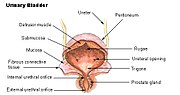 Thumbnail for Overactive bladder