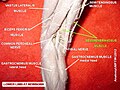 Semimembranosus muscle