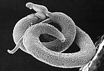 Thumbnail for Schistosoma mansoni