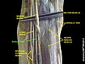 Basilic vein