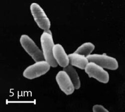 할로박테리아는(Halobacteria) 염분이 거의 포화상태인 물에서 발견되며, 현재는 고세균으로 인식되고 있다.