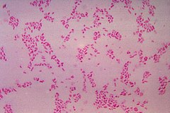 Bacteroides Fragilis