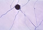 Thumbnail for Aspergillus niger