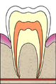 Possible tooth picture; but less anatomically correct