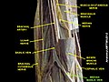 A dissection of the cubital fossa (inner elbow), labelling the median cubital vein.