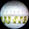 Spirogyra (Each numbered tick = 20 µM)