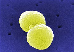 Streptococcus pneumoniae