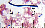 Thumbnail for Lactobacillus delbrueckii subsp. bulgaricus