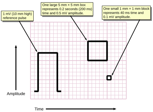 Measuring time and voltage with ECG graph paper