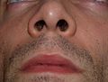 nostrils