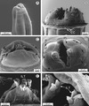 REM-Aufnahme der Kopfregion von Physaloptera ngoci: kräftige Lippen um eine spaltförmige Mundöffnung, Abb. B zeigt die Hautfalte (cephalic collarette, CC)