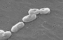 Scanning electron micrograph of Burkholderia cepacia