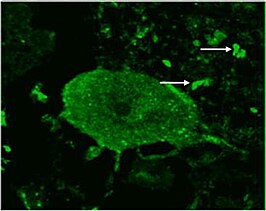 Gezond menselijk cerebellum, Purkinjecellaag, t = 36 weken na behandeling met rituximab gekleurd met een referentie anti-GAD65 monoklonaal antilichaam. Dunne pijlen tonen presynaptische terminale kleuring alleen met het anti-GAD65 monoklonale antilichaam