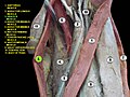 Gracilis muscle