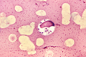 Forma amastigota de Leishmania donovani em uma célula da medula óssea.