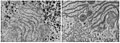 Vermehrung des glatten endoplasmatischen Retikulums (seR) in der Leberzelle einer Phenobarbital-behandelten Ratte (rechts); links Leberzelle einer unbehandelten Ratte