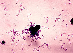 Description de l'image Streptococcus mutans 01.jpg.