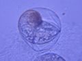 Dolabrifera dolabrifera egg 7 days old, just before hatching