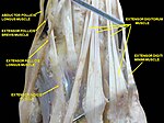 Muscle of the hand. Posterior view.