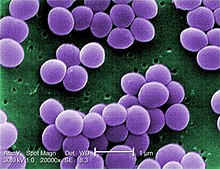 Scanning electron micrograph of "S. aureus"; false color added