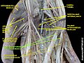 Flexor digitorum profundus muscle