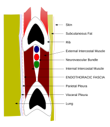 Schéma d'une coupe verticale d'un espace intercostal montrant de haut en bas, la côte supérieure, le paquet vasculo-nerveux avec dans l'ordre la veine, l'artère et le nerf, puis à distance la côte inférieure, de part et d'autre du paquet un muscle intercostal, l'un à l'extérieur, l'autre à l'intérieur