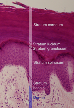 histologische coupe van de epidermis