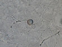 Oospore of Pythium sulcatum