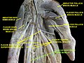 Flexor digitorum profundus muscle