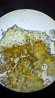 Uredinium