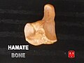 Hamate bone.